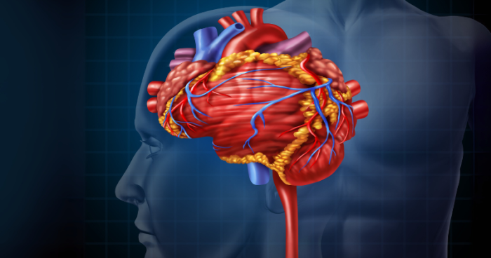 Stroke & South Asians